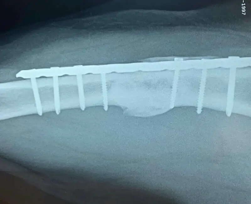 Equipo médico especializado